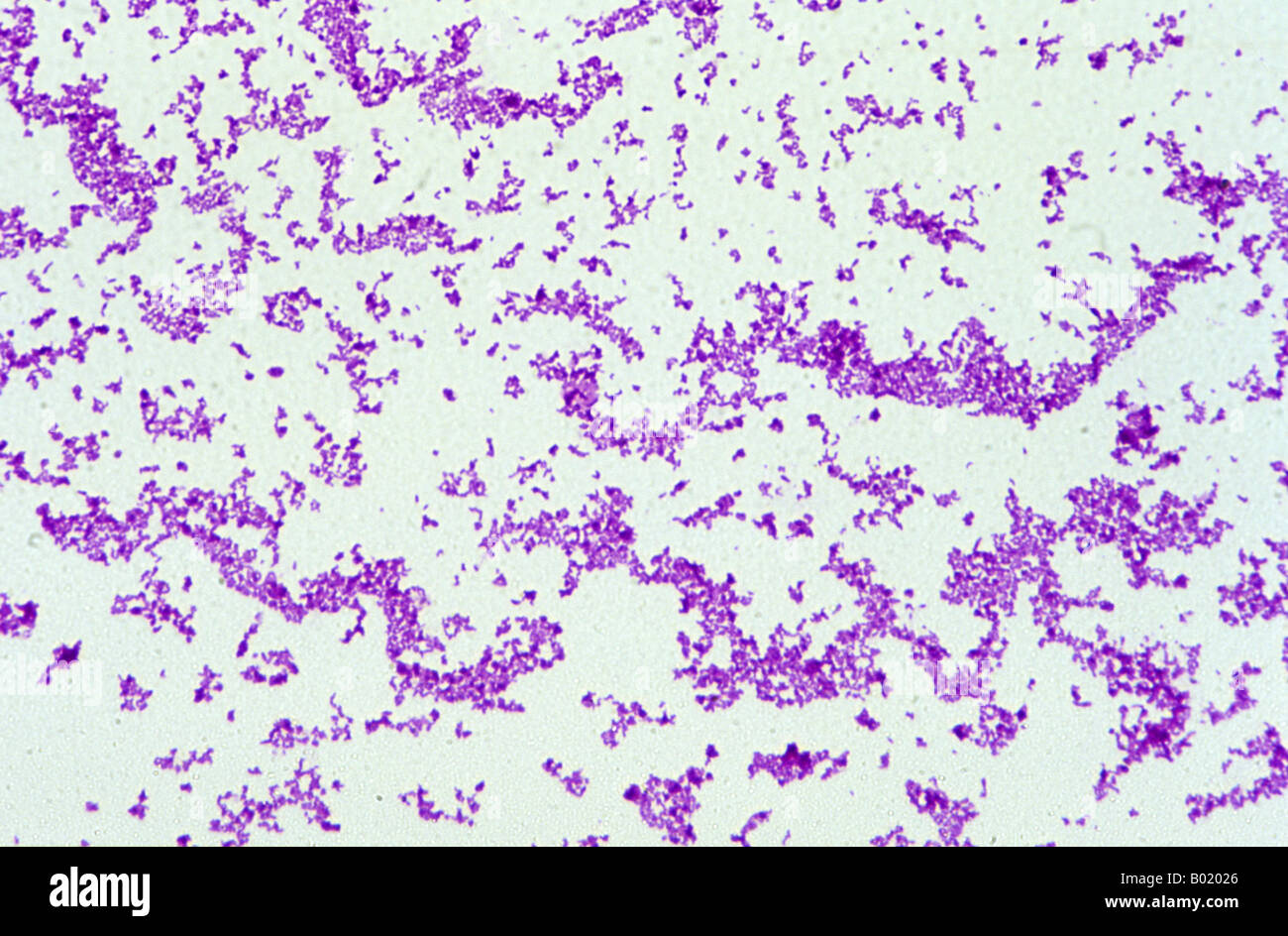 Corynebacterium Diphtheriae Bakterien Stockfoto