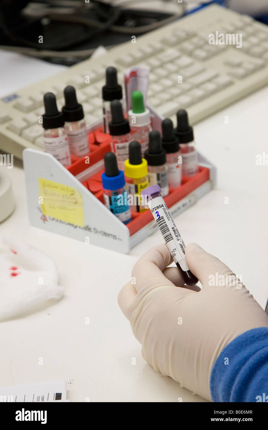 Detroit Michigan Techniker am Detroit Medical Center führen Blutuntersuchungen bestellt von Ärzten Stockfoto