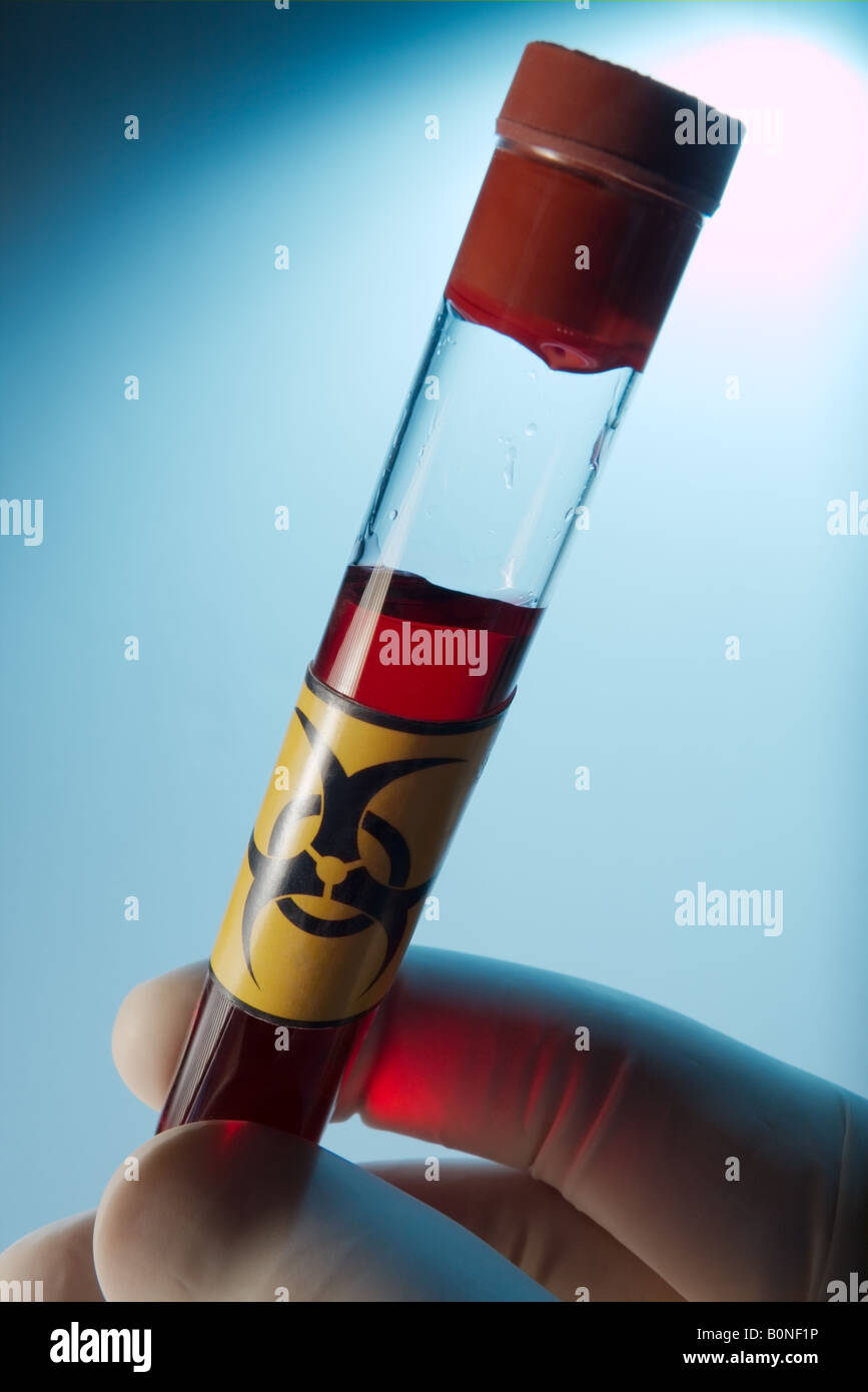 Reagenzglas mit roter Flüssigkeit gefüllt Stockfoto