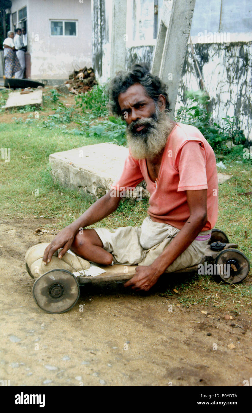 Alter Mann hat zum Opfer für Lepra in Colombo, Sri Lanka Stockfoto