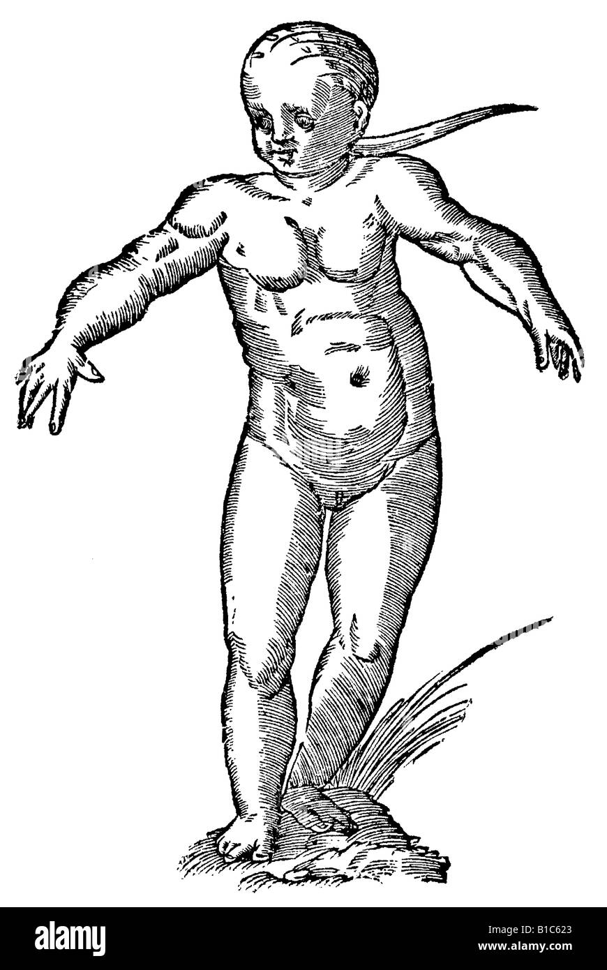 Infans Capite Thersitico, Aldrovandi, 1642, 17. Jahrhundert, Renaissance, Europa Stockfoto