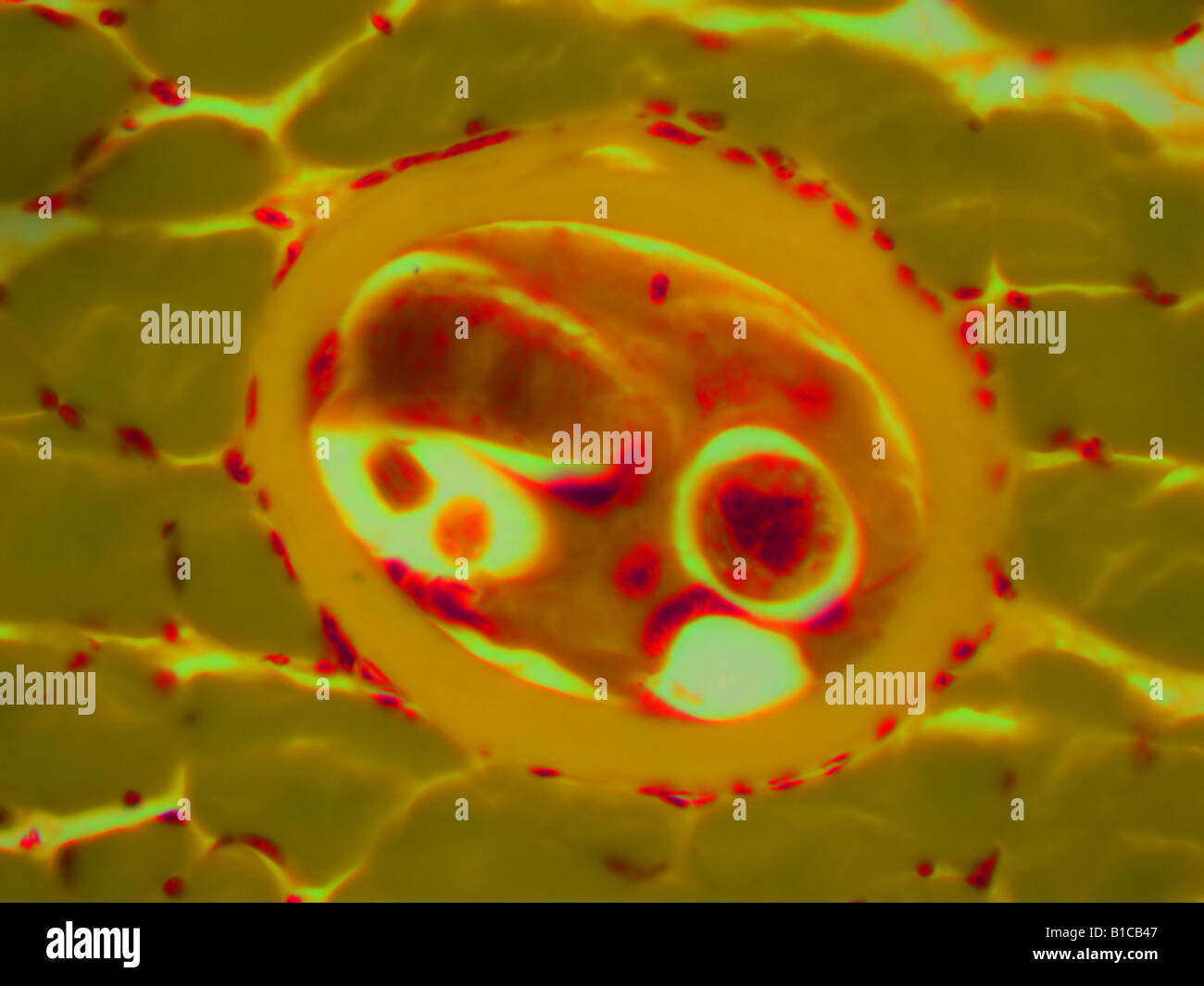 Trichinella Spiralis im Schweinefleisch-Gewebe Stockfoto