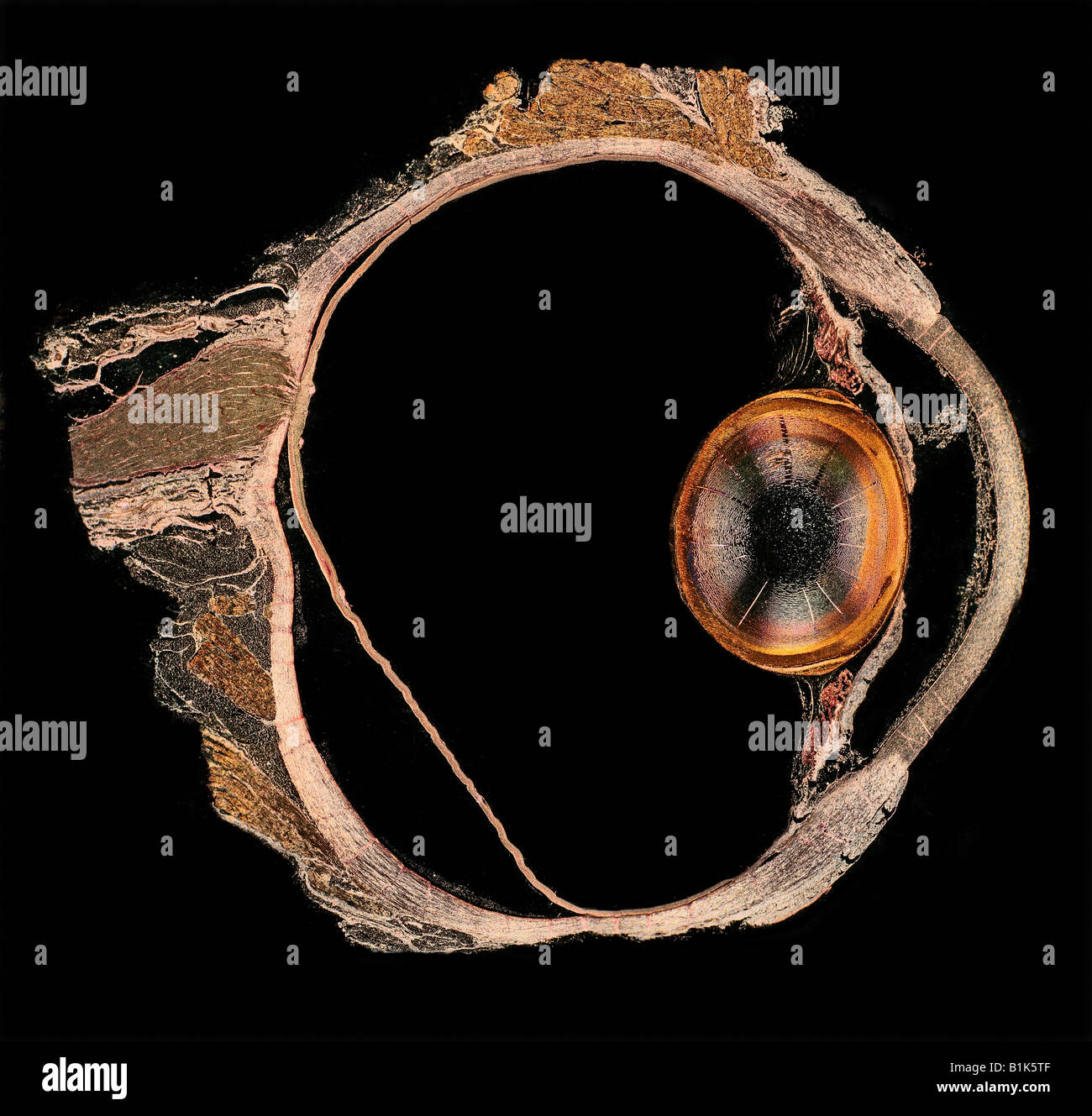Dunkelfeld Mikrophotographie eines Abschnitts des Auges Schwein zeigt Objektiv und Sehnerv fovea Stockfoto
