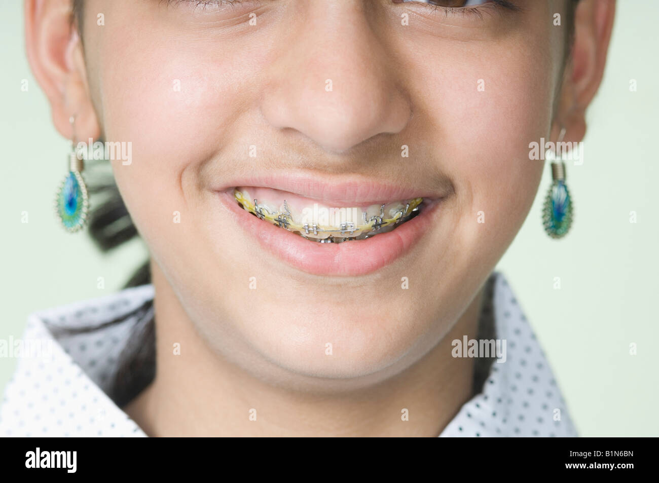 Nahaufnahme eines Mädchens tragen Zahnspangen Stockfoto