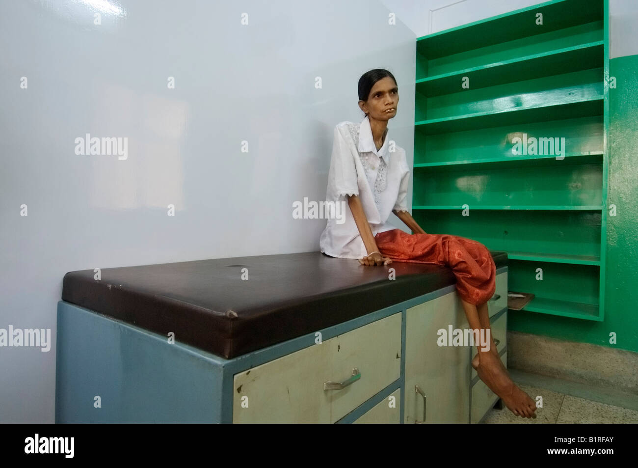 Ernsthaft krank Tuberkulose Patienten in einer TB-Klinik, Howrah, Hooghly, Westbengalen, Indien Stockfoto