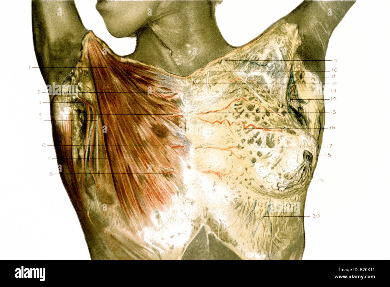 BRUSTMUSKEL ZEIGT AUF DER EINEN SEITE UND MILCHDRÜSEN AUF ANDERE ILLUSTRATION DISSEKTION WEIBLICHE THORAX Stockfoto
