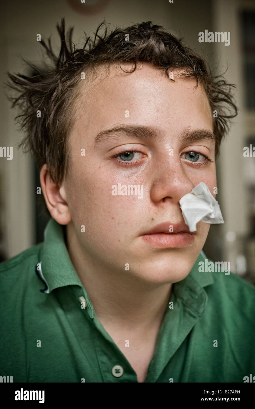 13 Jahre alter Junge mit einem Stück Papier Gewebe in der Nase Stockfoto