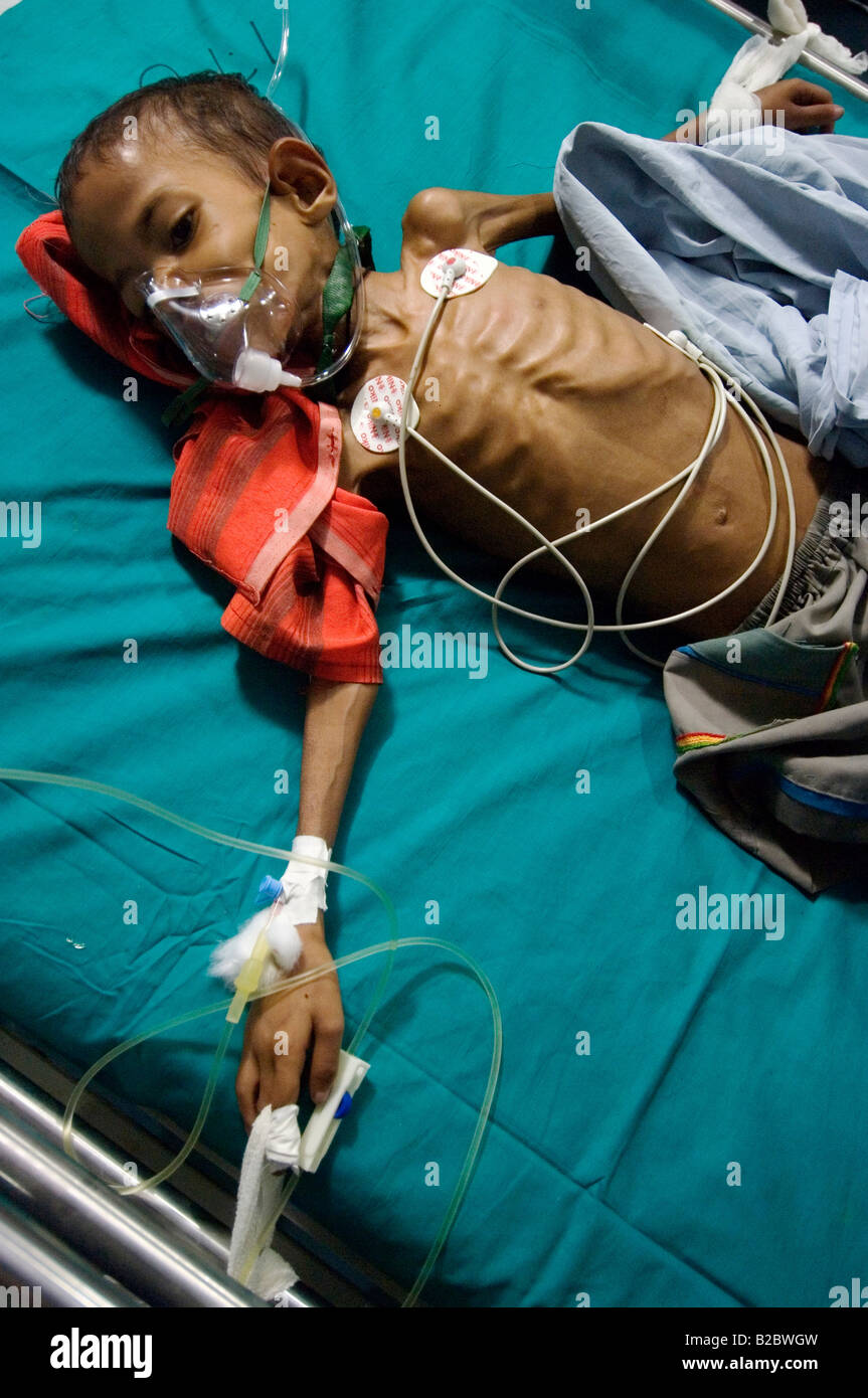 Kleine Rotique, 9, ist schwer krank mit TBand ergriffen, um die Intensivstation des Krankenhauses Shree Jain zu den Kosten Stockfoto