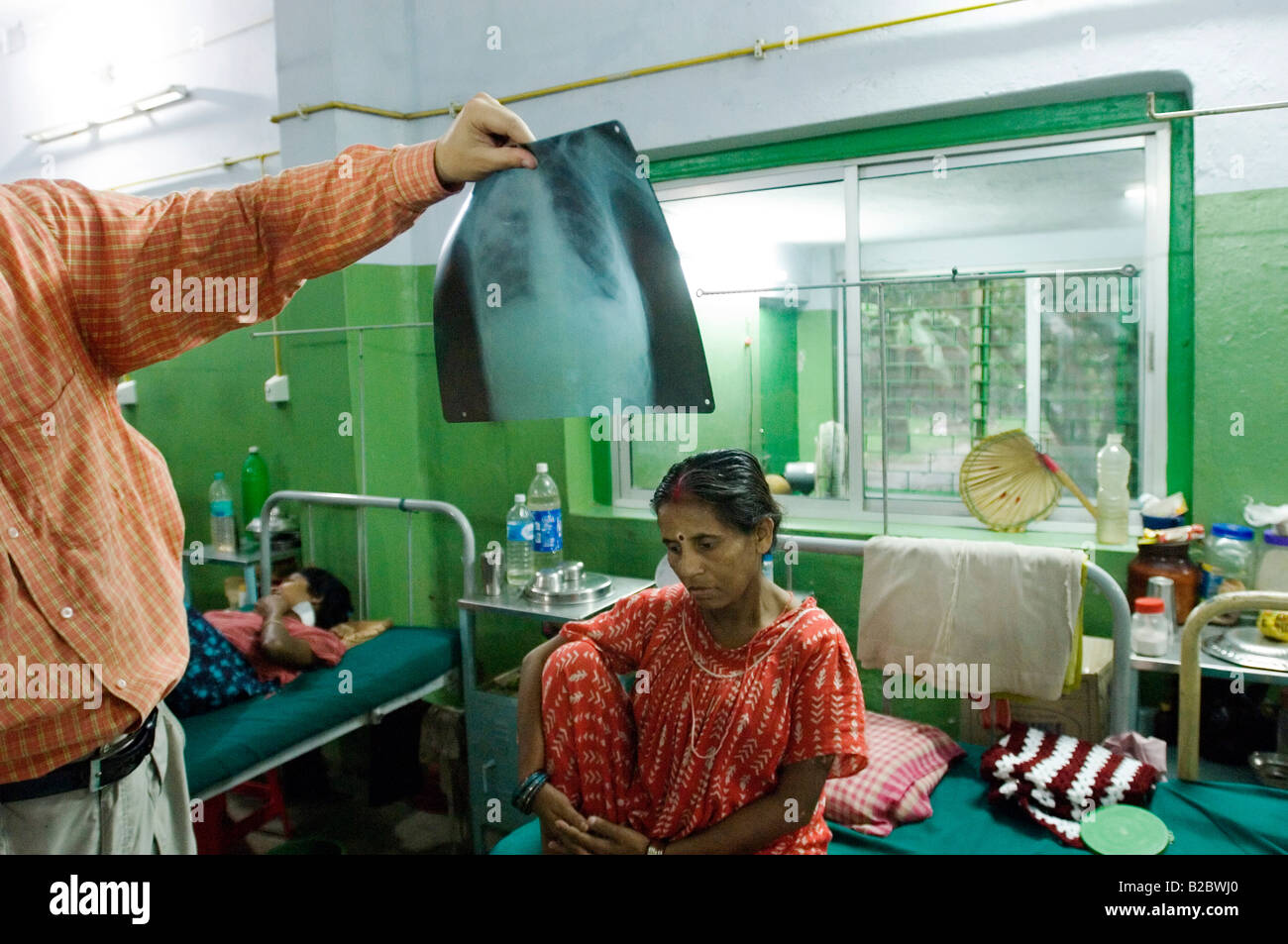 Aroti Devi, 36, mit spinalen Tuberkulose während des Arztes runden St. Thomas Zuhause, einer Spezialklinik für TB, Howrah Stadt Stockfoto