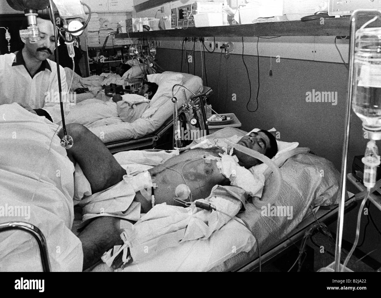 Ereignisse, Iran-Irak-Krieg 1980 - 1988, verletzt in einem Krankenhaus, Iraker, ca. 1985, Opfer, medizinischer Dienst, Iran, 20. Jahrhundert, historisch, historisch, Menschen, 1980er Jahre, Stockfoto