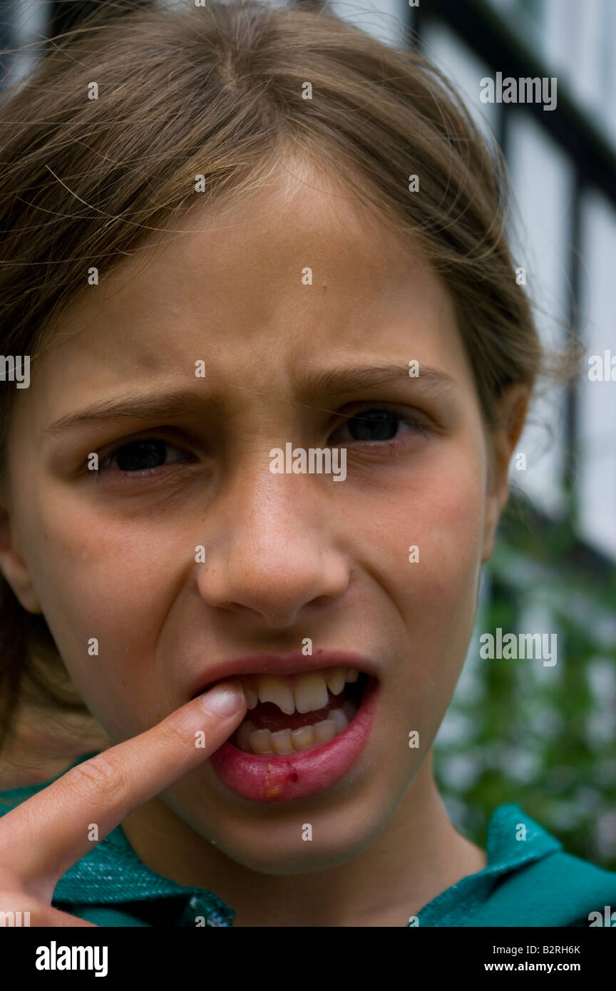 Mädchen Kind Porträt ernst Zahn gebrochen Stockfoto