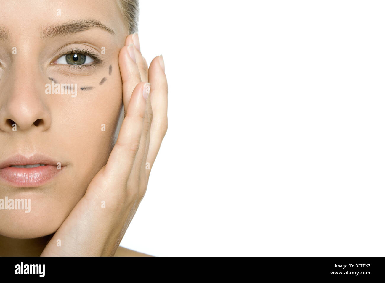 Frau mit plastischen Chirurgie Markierungen unter ihrem Auge, Nahaufnahme, beschnitten Stockfoto