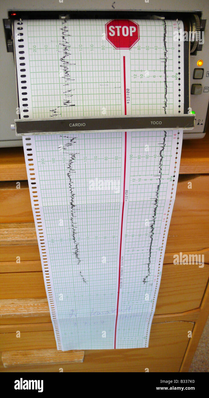 CTG, cardiotocograph Stockfoto