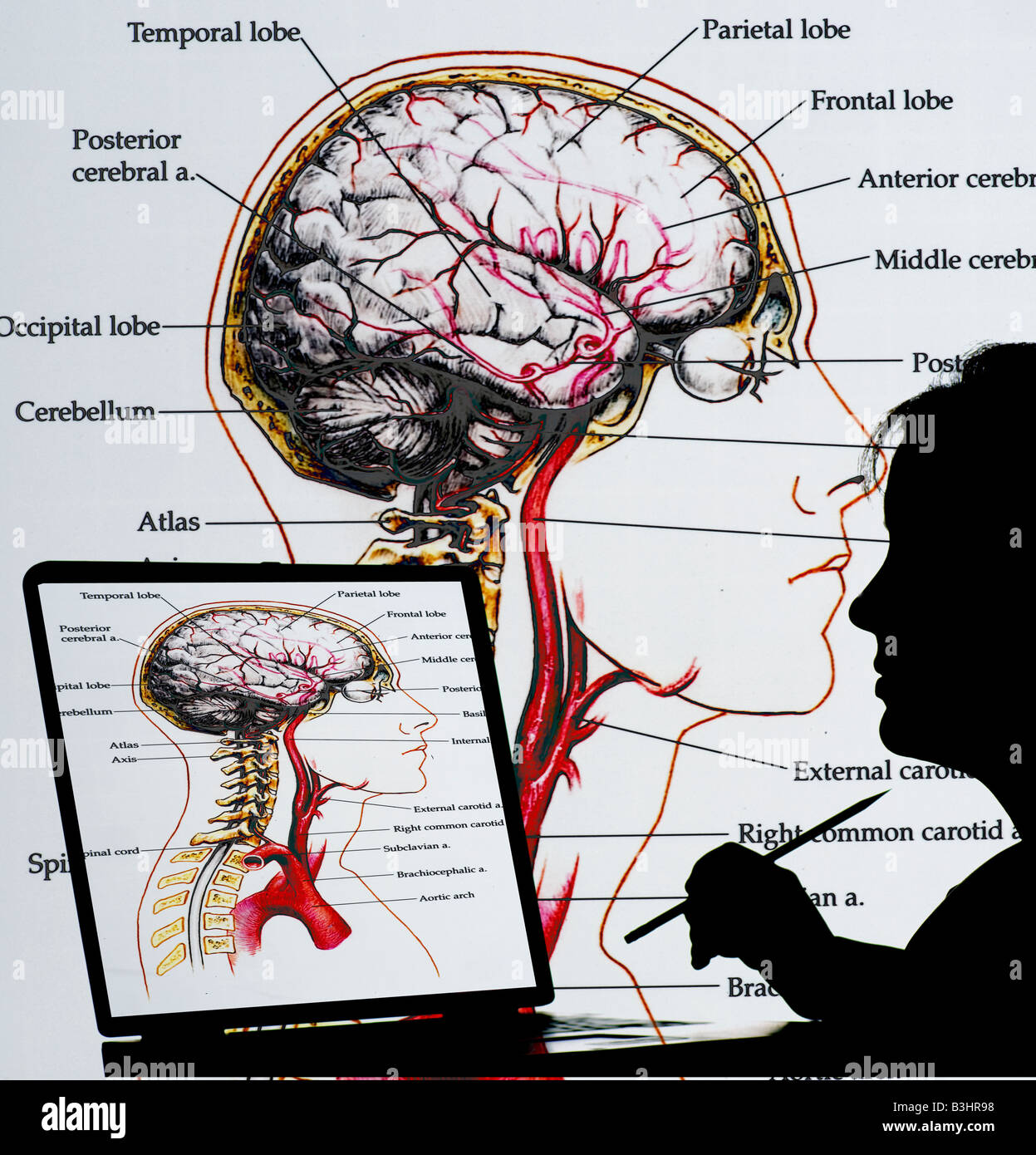 Techniker Studium Computer generiert Gehirn Abbildung Stockfoto