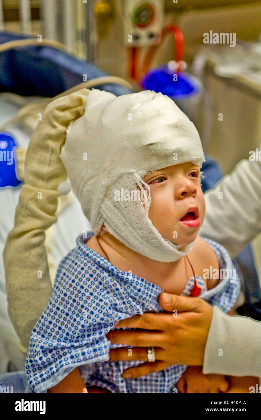 Eine Säuglinge junge in einem California Krankenhaus spinal Bifida leidet trägt eine Elektrode gefüllten EEG Kappe süchtig zu überwachen Stockfoto