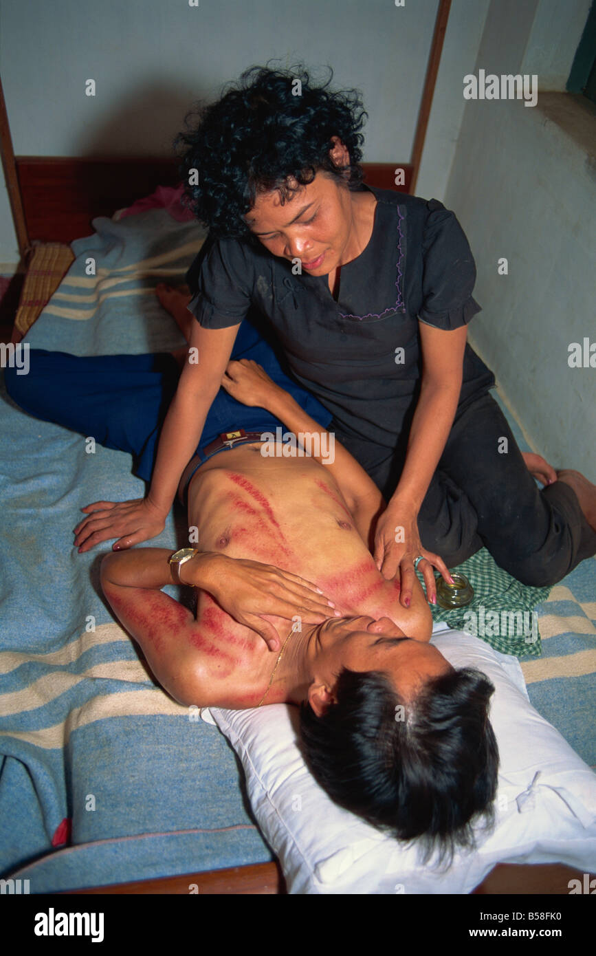 Traditionelle Massage Kambodscha Indochina Südost-Asien Asien Stockfoto