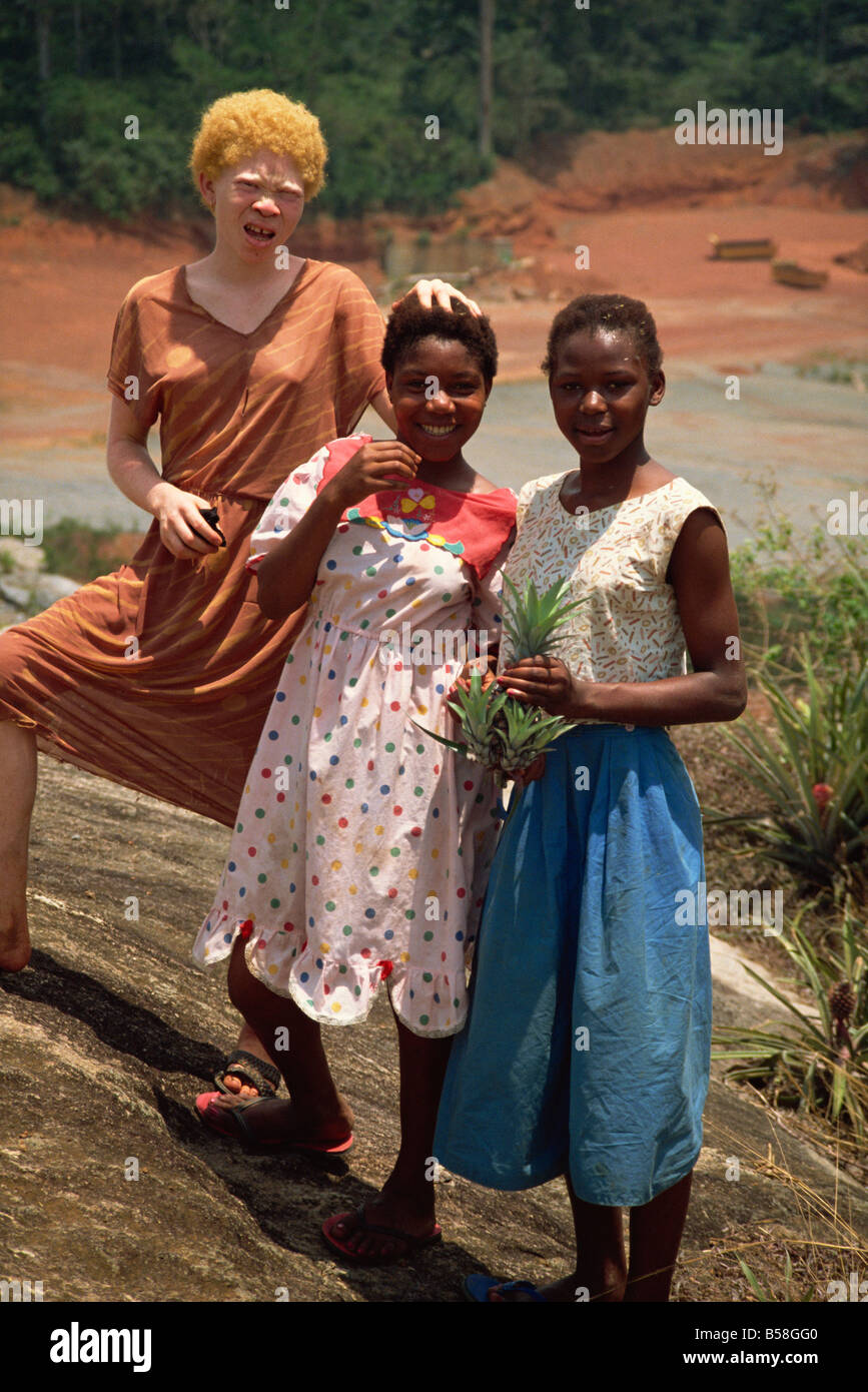 Drei Mädchen darunter Albino Mädchen Sangmelima Kamerun Westafrika Afrika Stockfoto