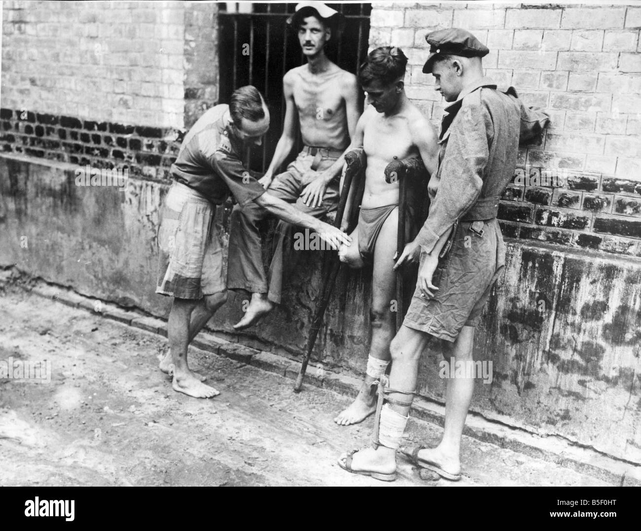 Kriegsgefangene in Rangun in einem sehr schlechten Gesundheitszustand nach unter schrecklichen Bedingungen leben entlassen. Corporal Usher Leben wurde gerettet von Major McLeod des indischen medizinischen Dienstes, der sein Bein ohne Betäubung nach Infektion inmitten amputiert.; 2. Mai 1945. Stockfoto