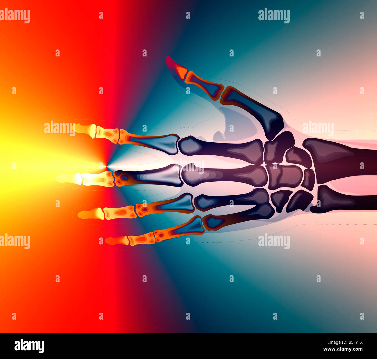 computergenerierte Röntgen-Darstellung der menschlichen Hand auf medizinischer monitor Stockfoto