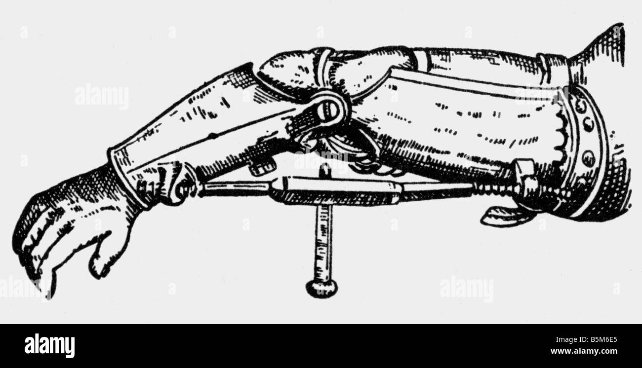 Medicien, Anatomie, künstliche Gliedmaßen, Armprothese von Ambroise Pare, Kupferstich, 16. Jahrhundert, Stockfoto