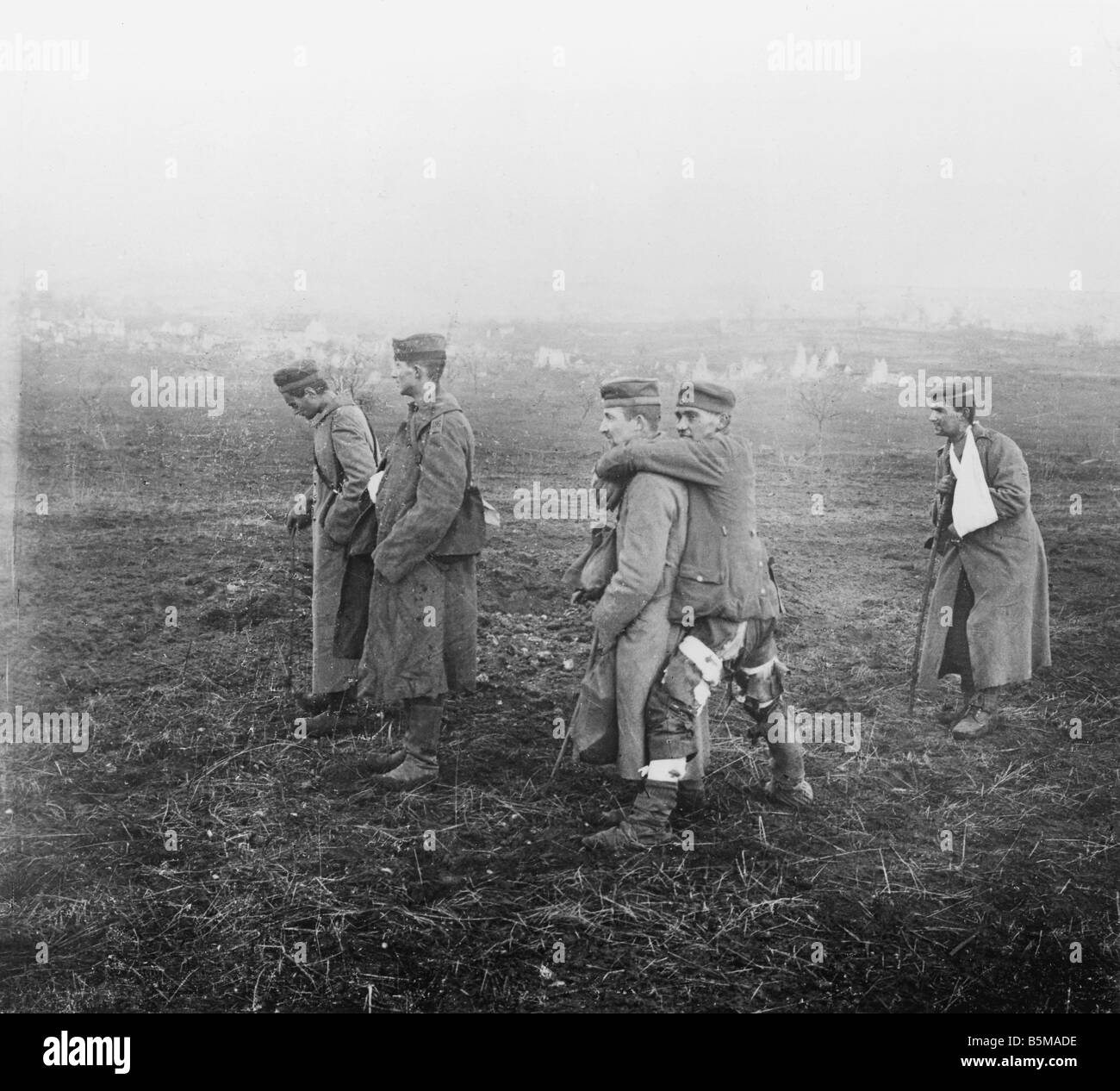 2 G55 W1 1917 24 E Wounded deutsche Truppen Aisne WWI Geschichte Weltkrieg einer westlichen Front Aisne Wounded deutsche Soldaten Foto Undat Stockfoto