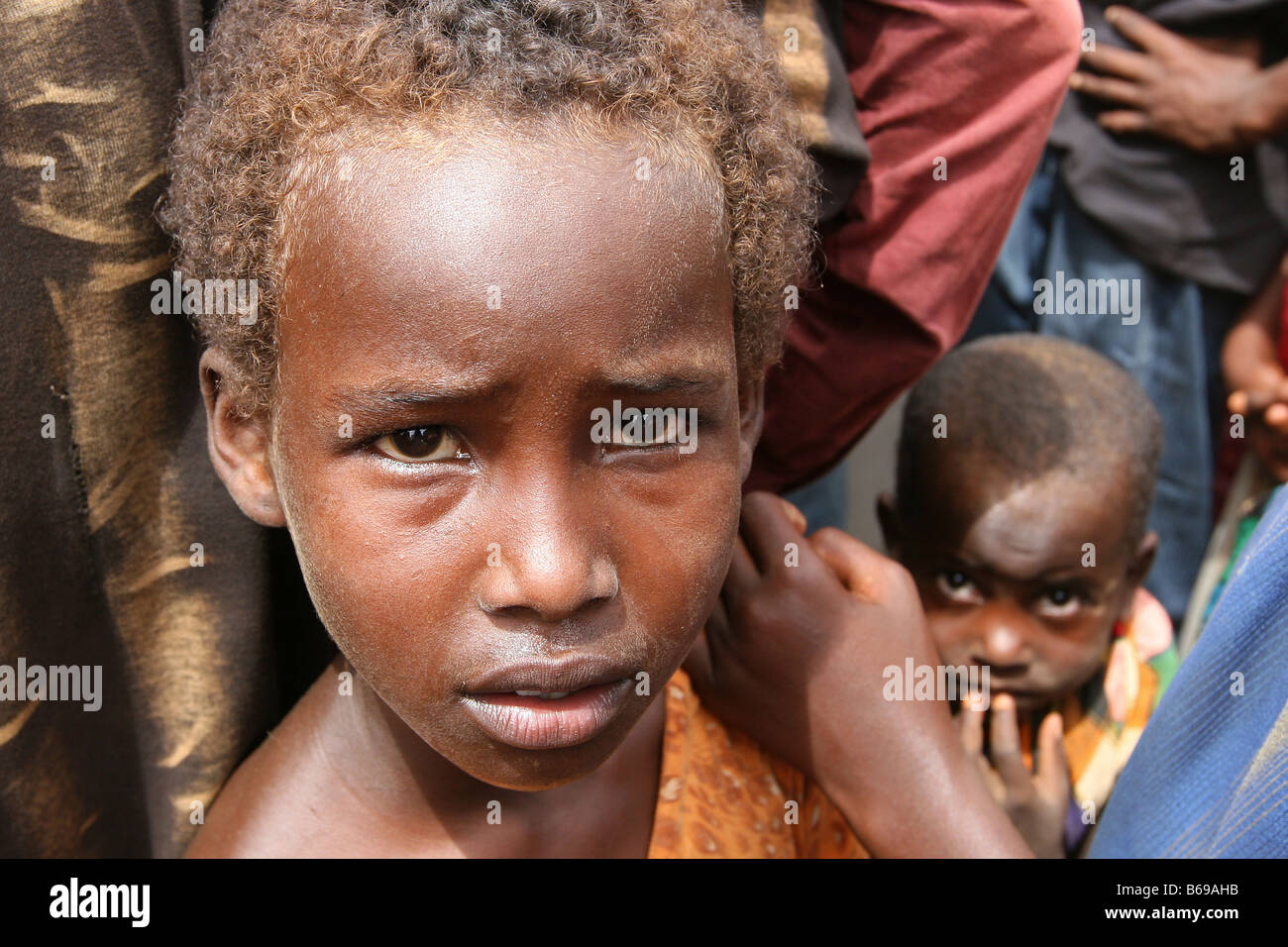 Unterernährten somalischen Flüchtling junge im Flüchtlingslager in Dadaab, an der Grenze von Somalia und Kenia Stockfoto