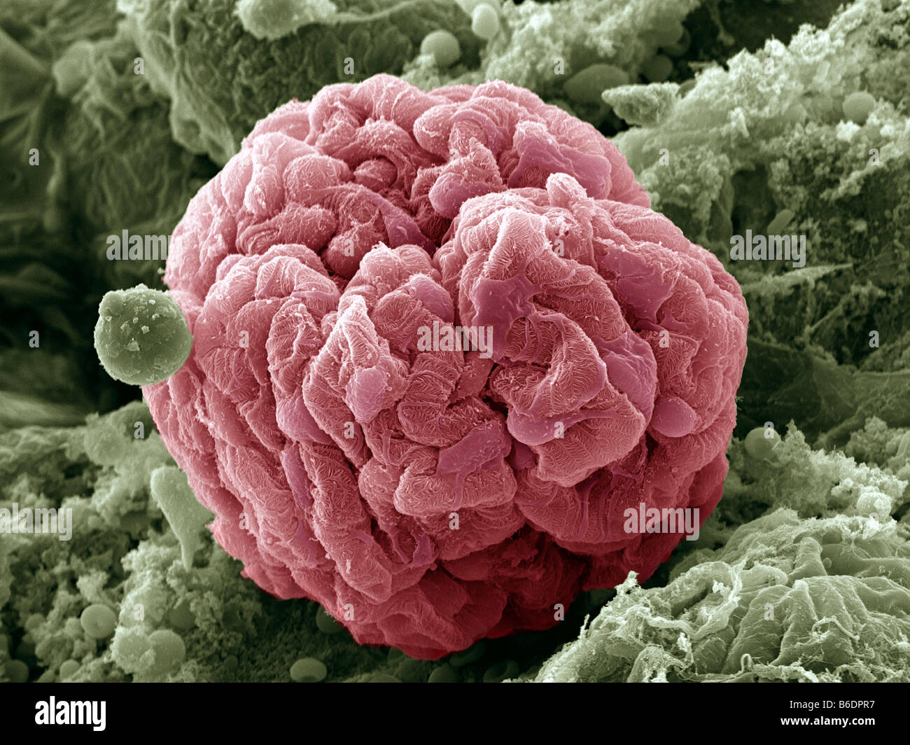Nieren Glomerulus, farbige scanning Electron Schliffbild (SEM). Hemolytic Zellen Stockfoto