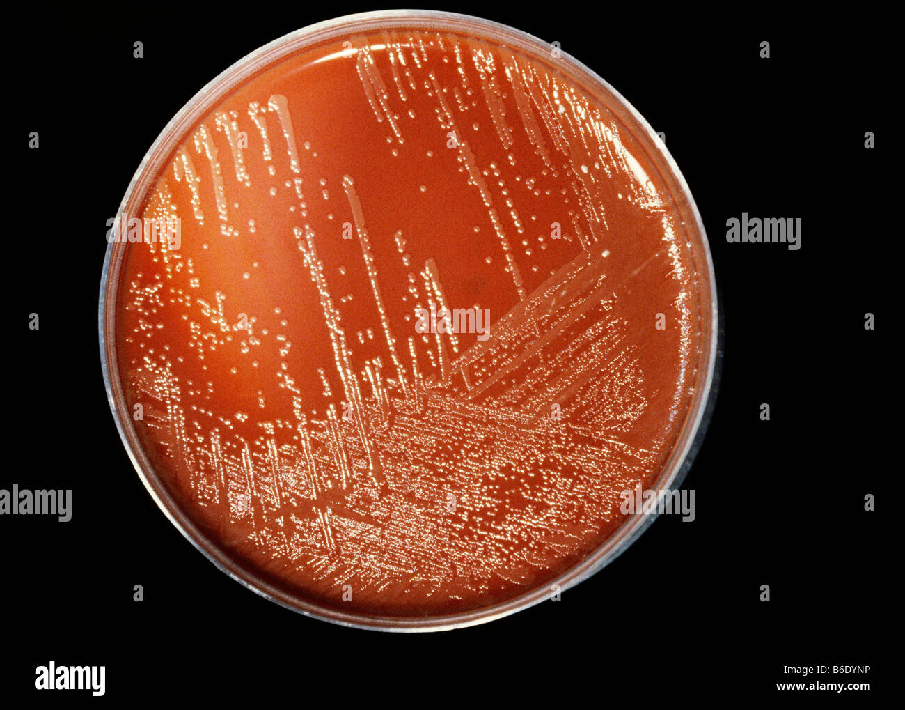 Meningitis-Bakterien. Neisseria Meningitidis Kolonien (weiß) auf einem Agar Wachstumsmedium (braun) in einer Petrischale kultiviert wird. Stockfoto