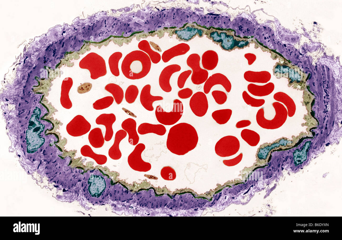 Arterie, farbige Übertragung Elektronen Schliffbild (TEM) von einem Querschnitt durch eine Arterie Stockfoto
