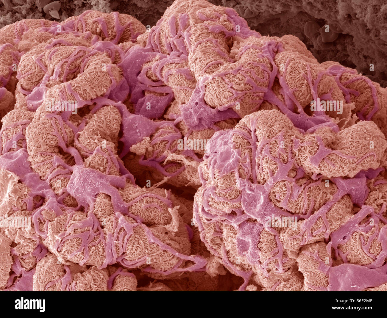 Glomerulus der Niere. Farbige Electronmicrograph (SEM) zeigt die Oberfläche des Aglomerulus scannen. Stockfoto