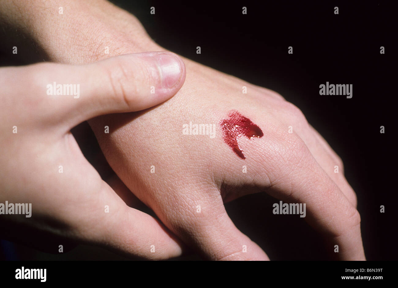 Blut fließt aus kleinen Wunde auf der hand. Stockfoto