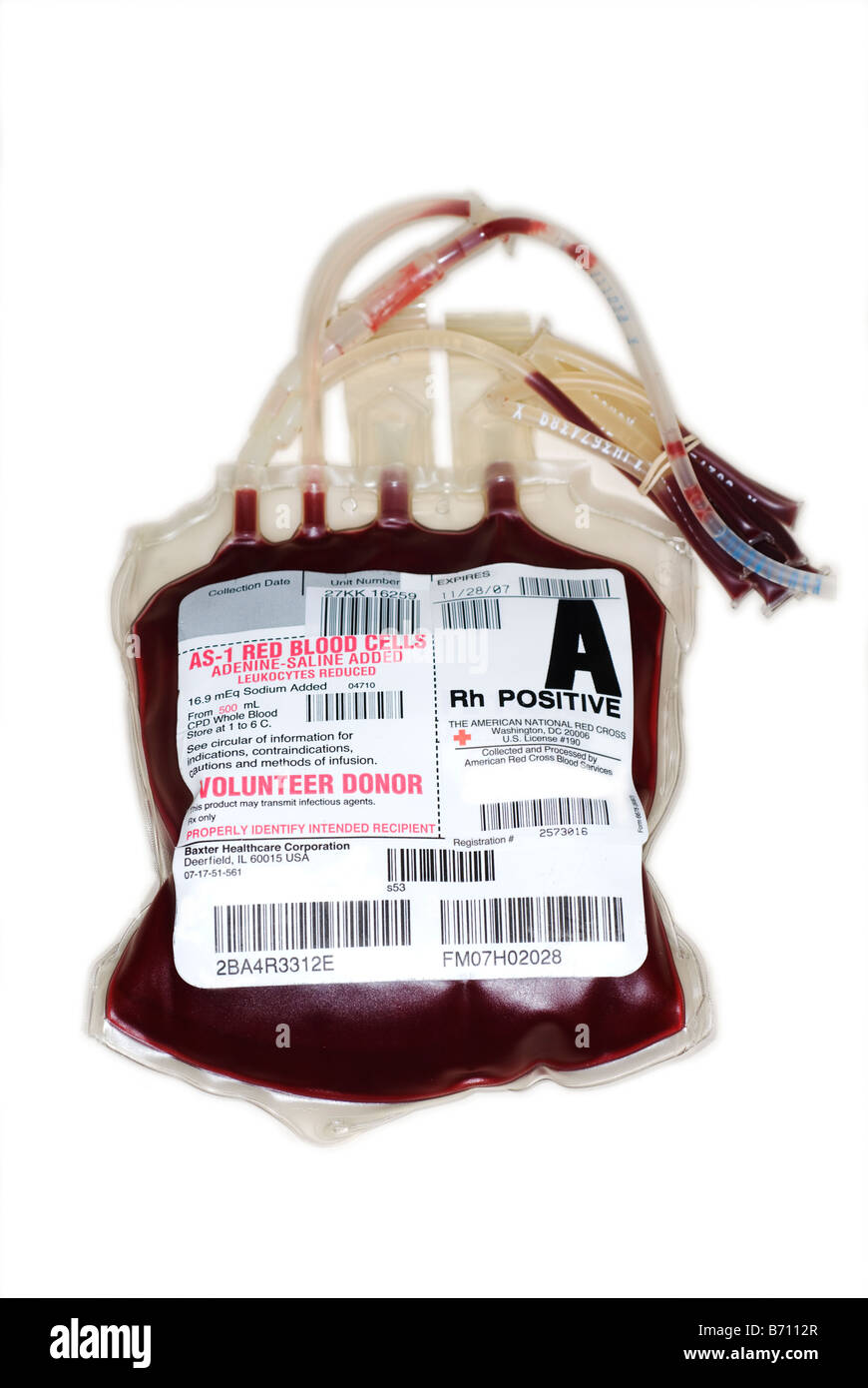 Einheit von Blut für Transfusionen Stockfoto