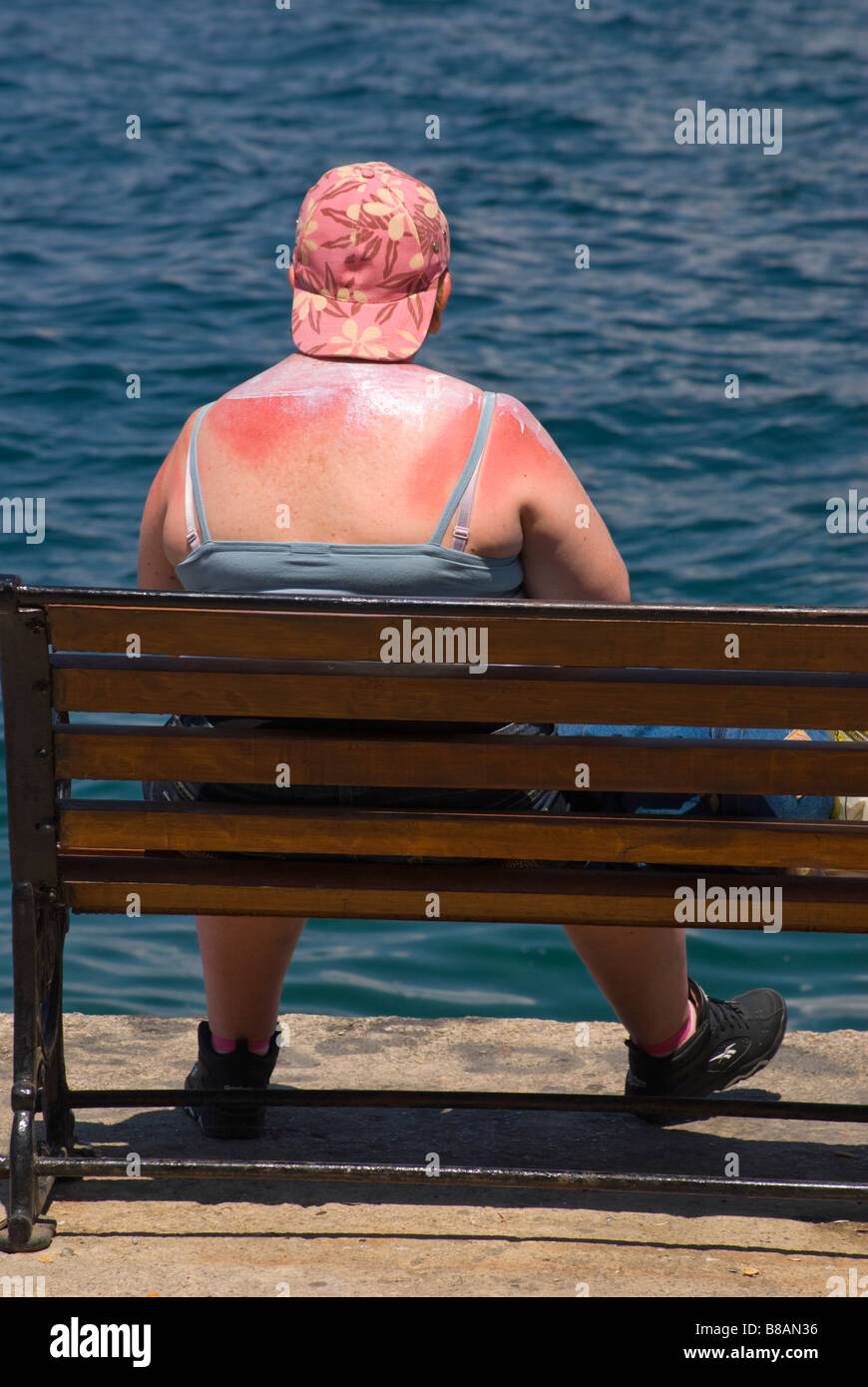 Chania / Chania, Kreta, Griechenland. Sonnenverbrannte Frau mit Lotion auf Schultern, sitzen am Meer Stockfoto