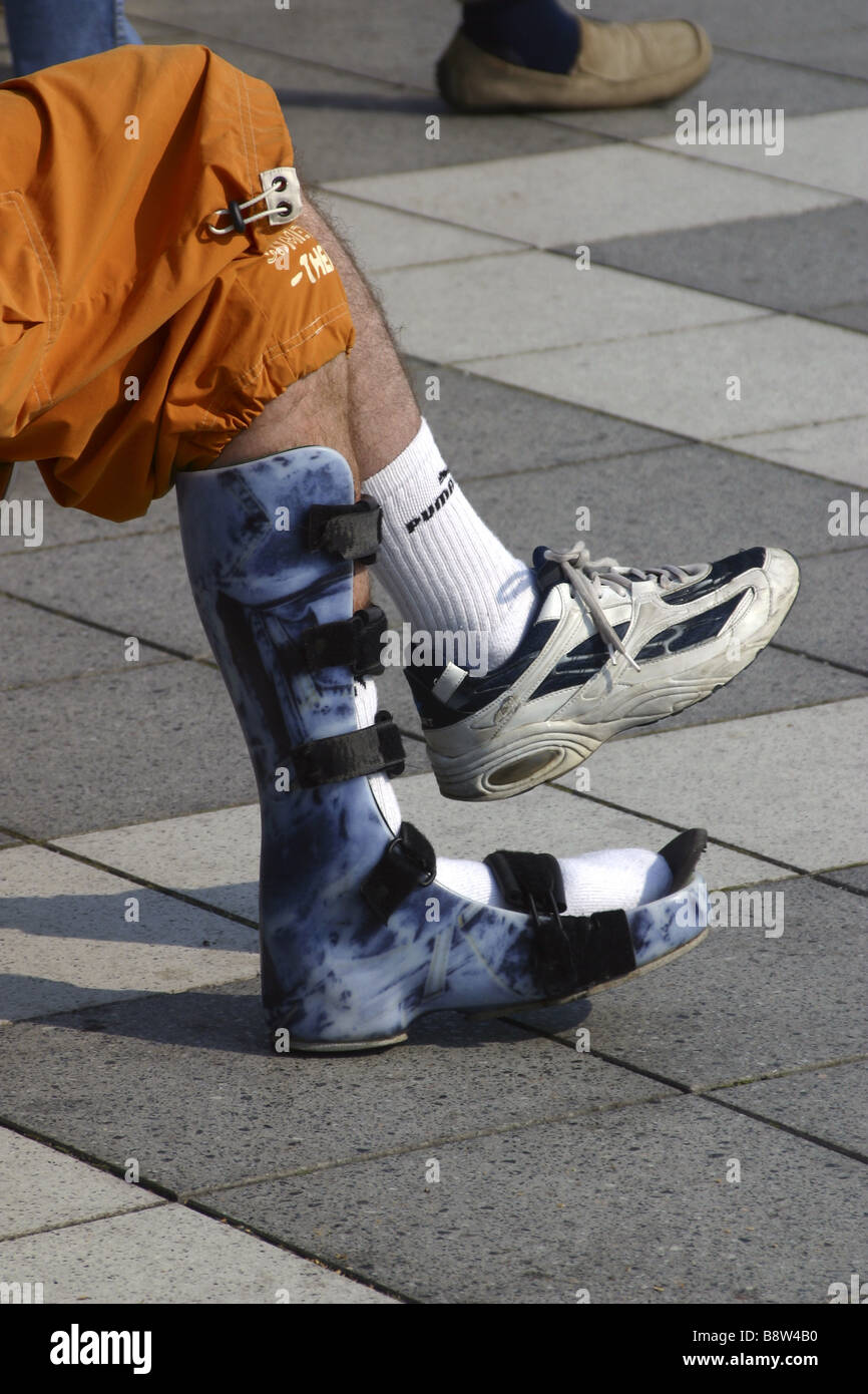 Mann mit Bein-Schiene Stockfotografie - Alamy