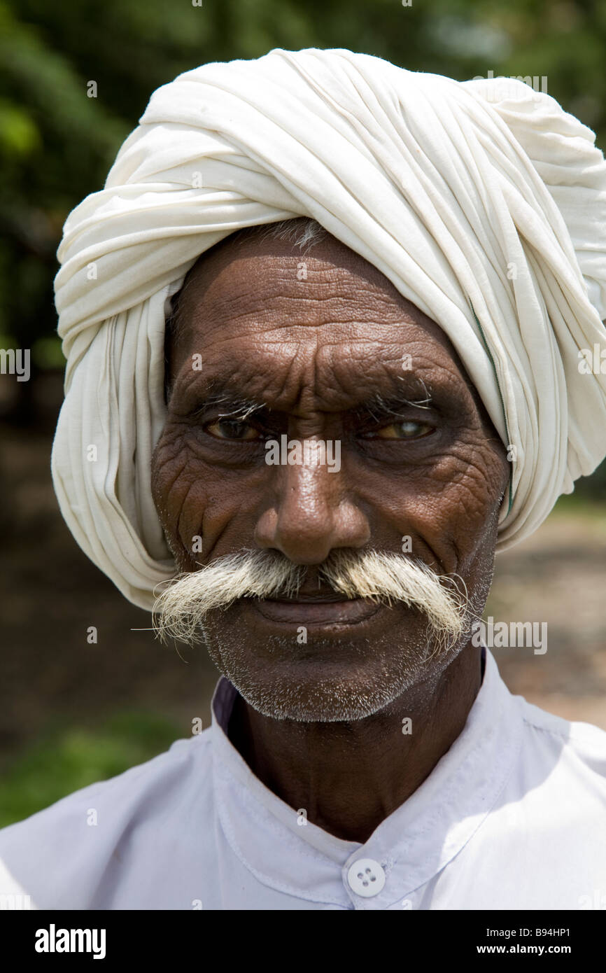 SIHK-Mann mit einem Auge Katarakt. Surat, Gujarat. Indien. Stockfoto