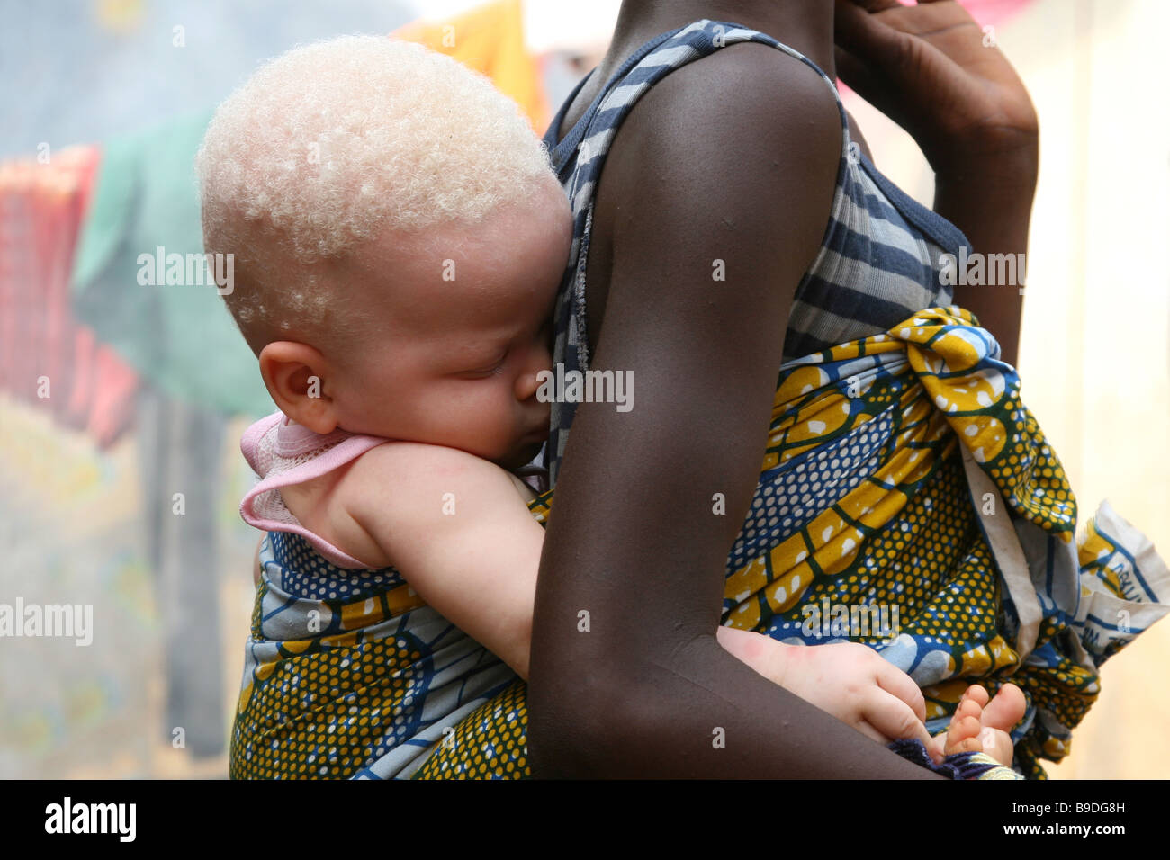 Albino-Mädchen in Sierra Leone, Afrika, auf der Rückseite ihrer Schwester Stockfoto