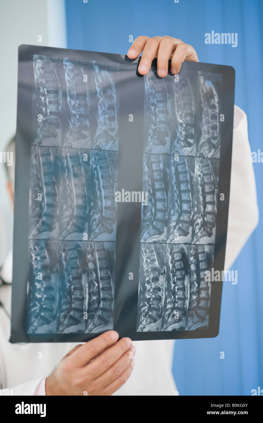 Arzt untersucht einen Röntgen-Bericht Stockfoto