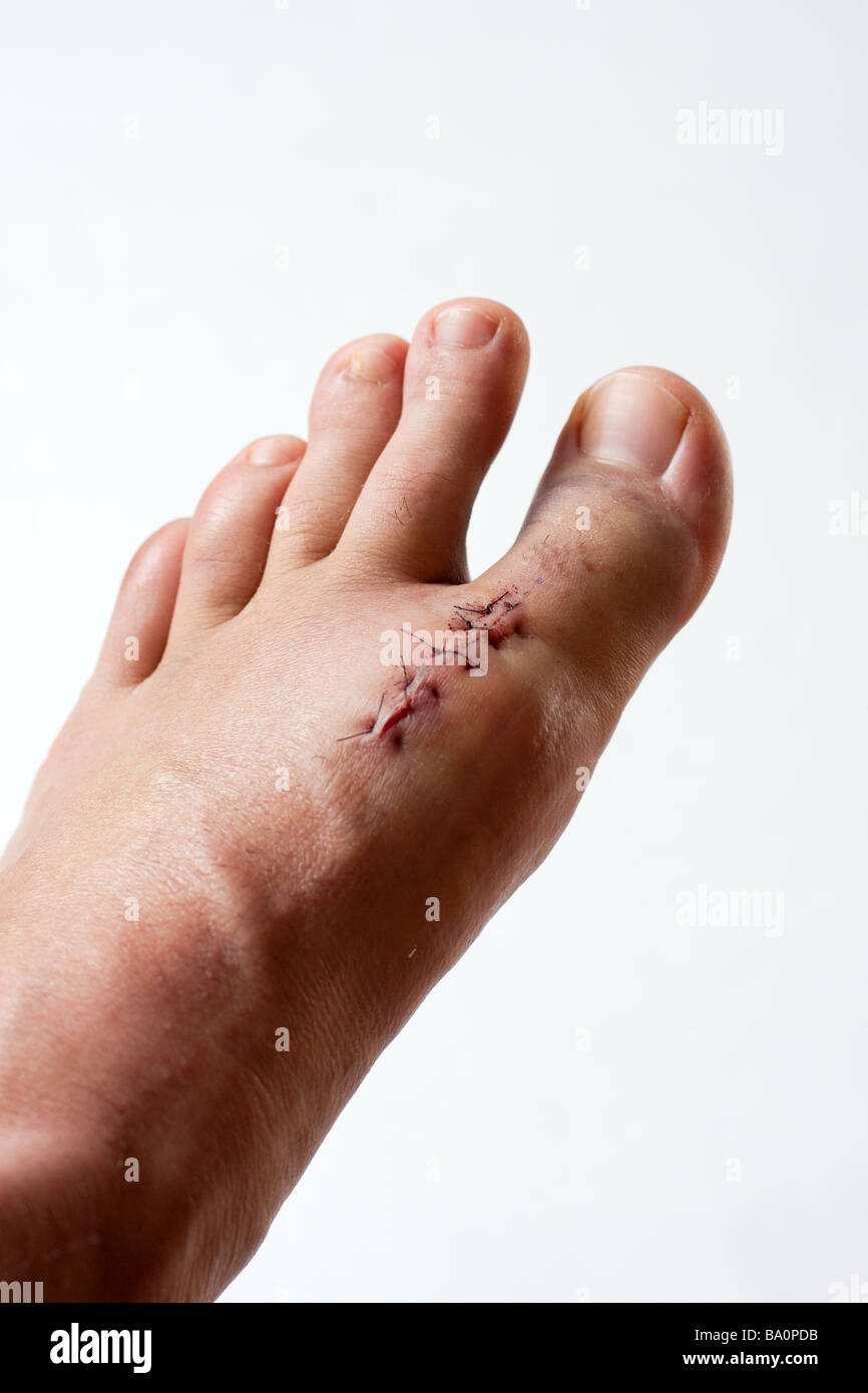 Linker Fuß Stockfoto