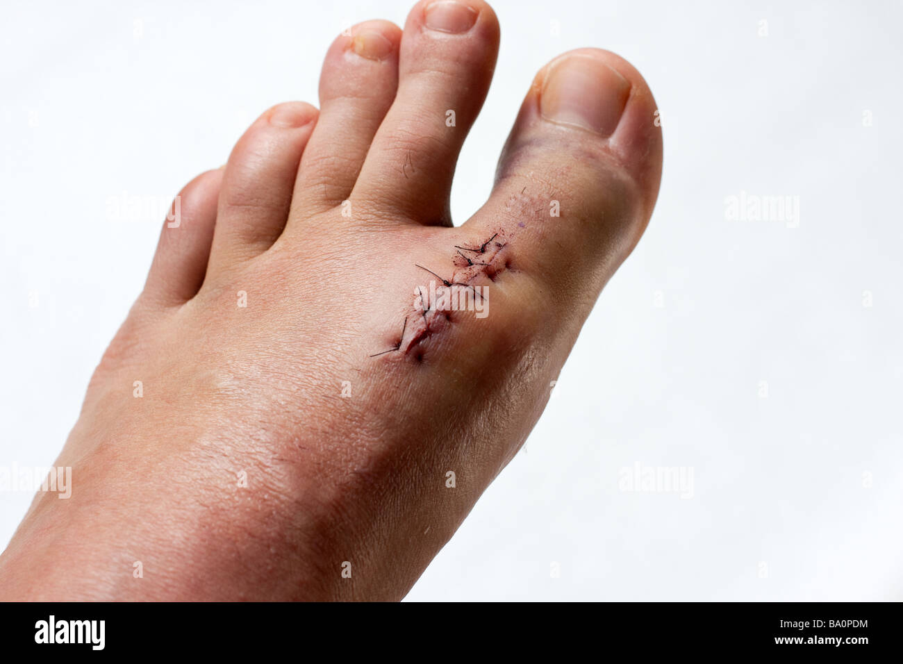 Linker Fuß Stockfoto