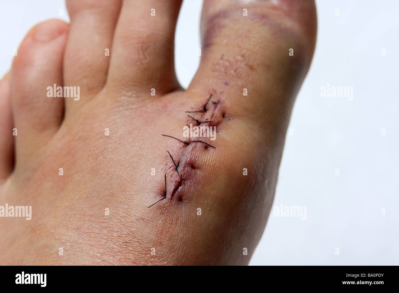 Linker Fuß Stockfoto