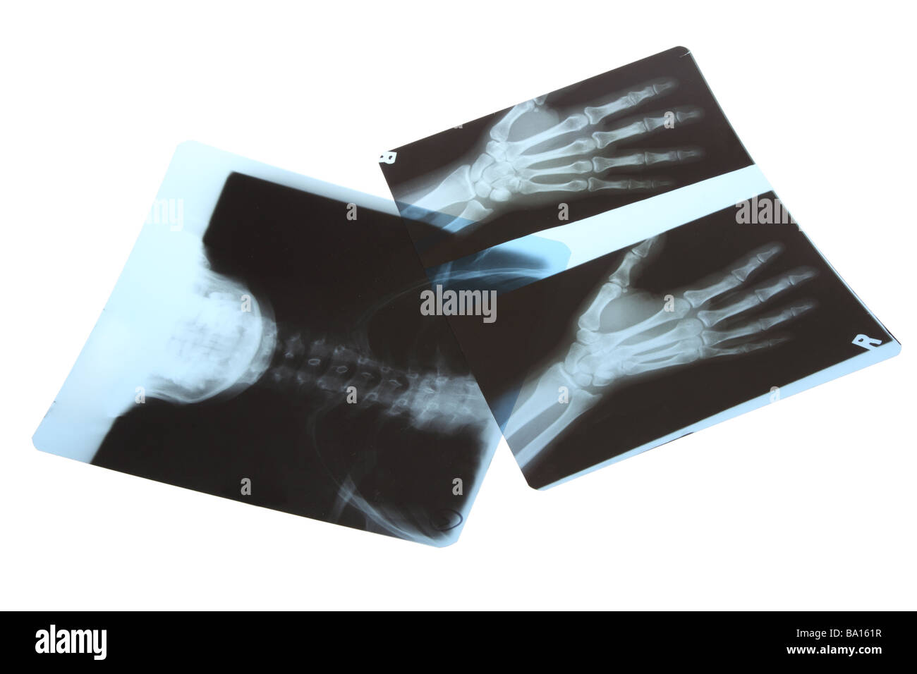 XRAY Film Ausschnitt auf weißem Hintergrund Stockfoto