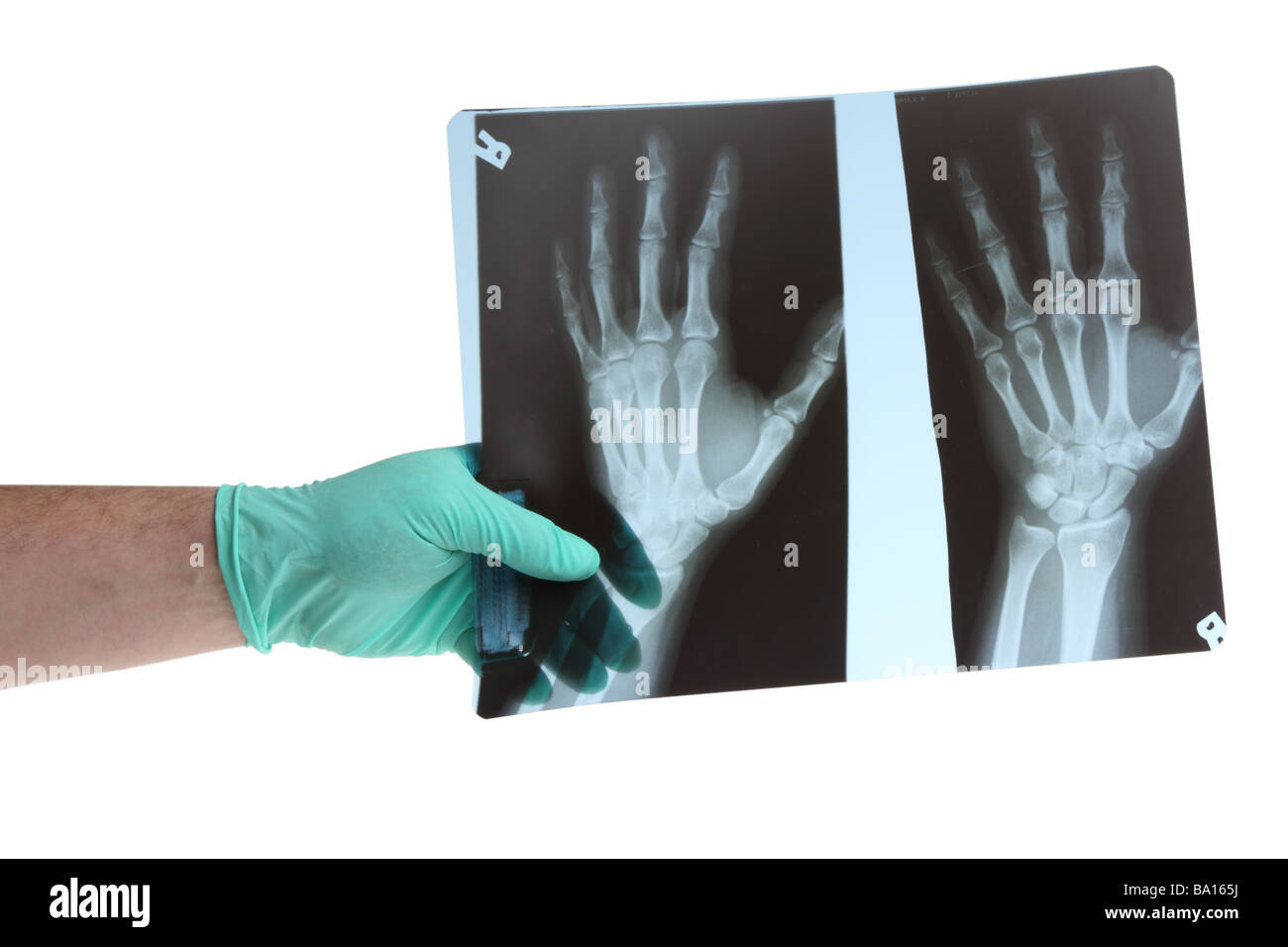 Ärzte-Hand mit Xray Ausschnitt auf weißem Hintergrund Stockfoto