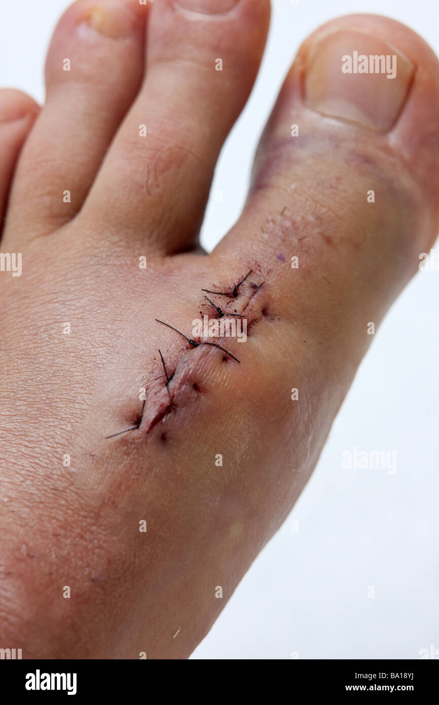 Linker Fuß Stockfoto