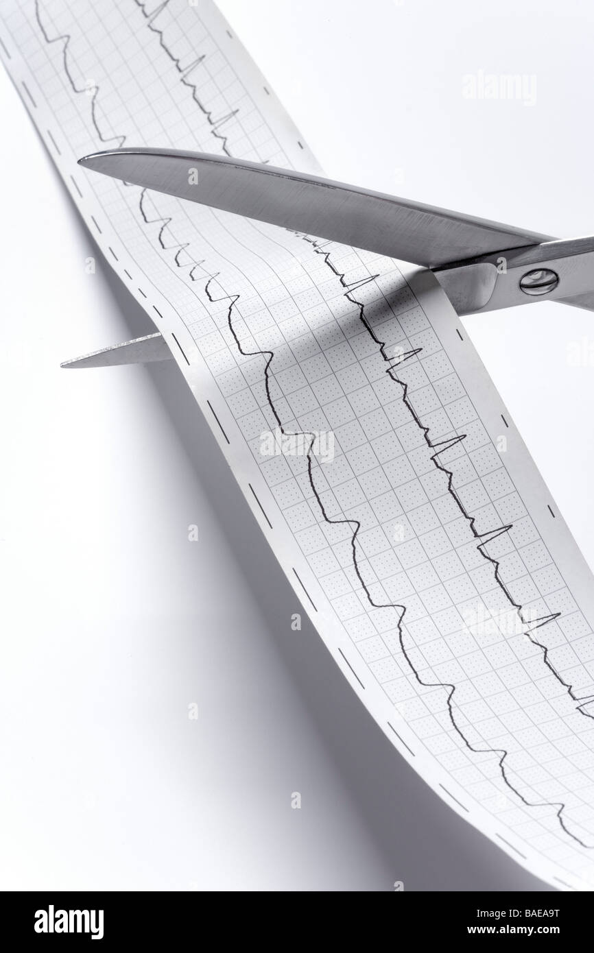 Regelmäßige Elektro Kardiogramm schneiden mit der Schere als Warnung Stockfoto