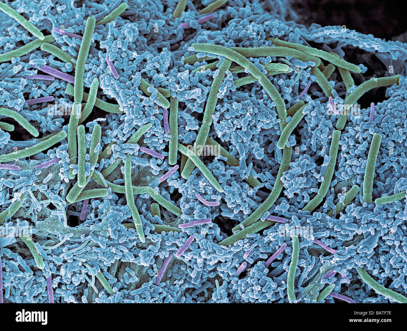 Zahnbelag, farbigen Scan Electronmicrograph (SEM). Plaque besteht aus Bakterien, die in einem Glykoprotein-Matrix eingebettet. Stockfoto