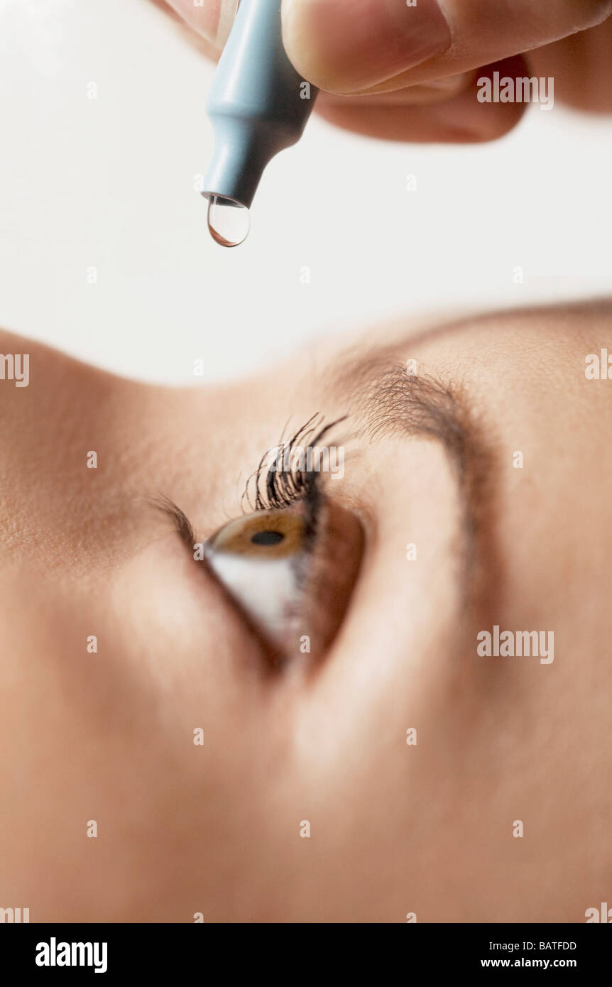 junge Frau Augentropfen Anwendung ins Auge Stockfotografie - Alamy