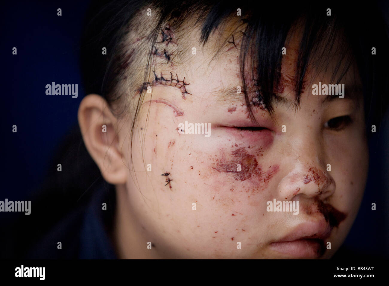 Sichuan-Erdbeben-Überlebenden in Mianyang, China. Stockfoto