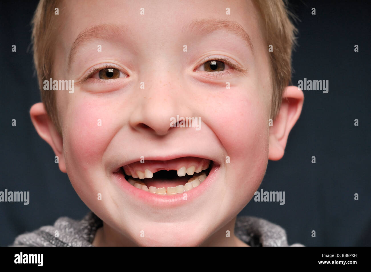 Porträt eines kleinen Jungen fehlen zwei Vorderzähne Stockfoto