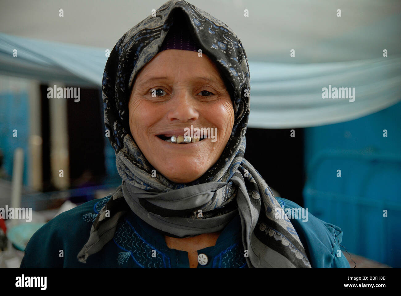 Ein Portrait eines weiblichen LepraPatienten, die viele Jahre in