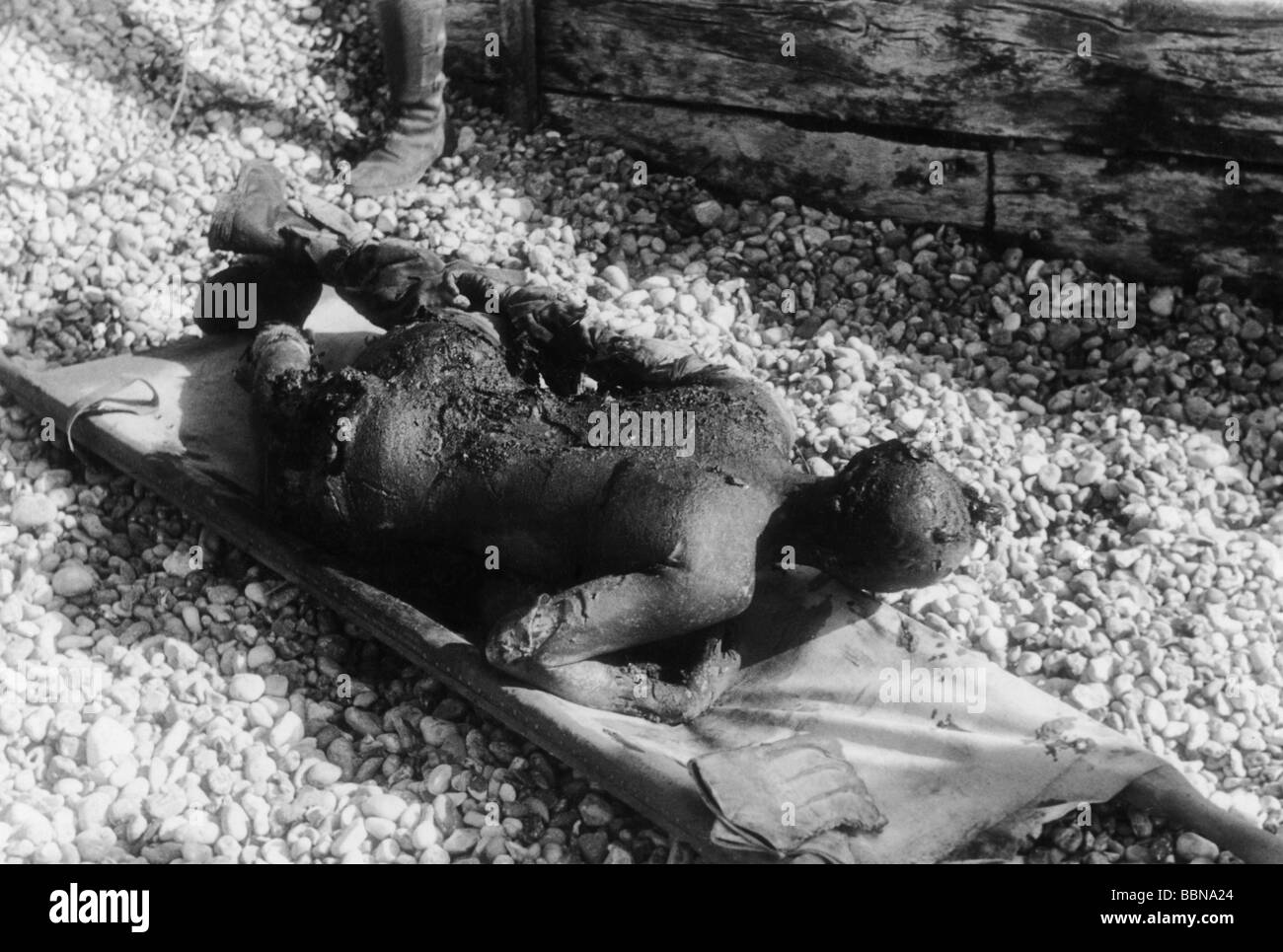 Ereignisse, Zweiter Weltkrieg/Zweiter Weltkrieg, Frankreich, Dieppe, 19.8.1942, verbrannter Soldat auf einer Bahre, Stockfoto